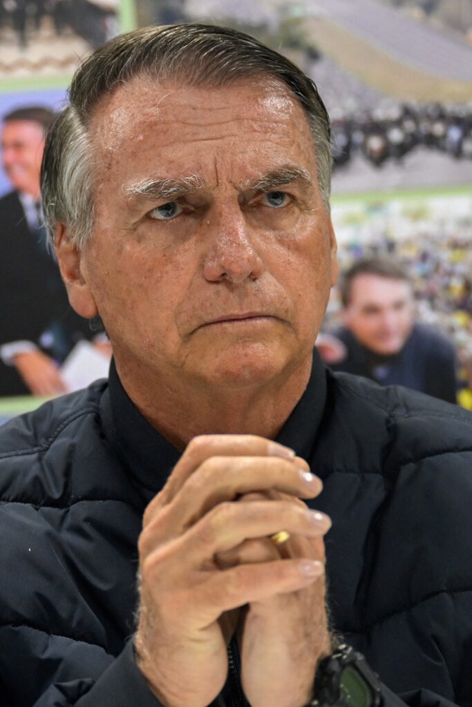 Bolsonaro está inchado e irritado no hospital, diz Carlos